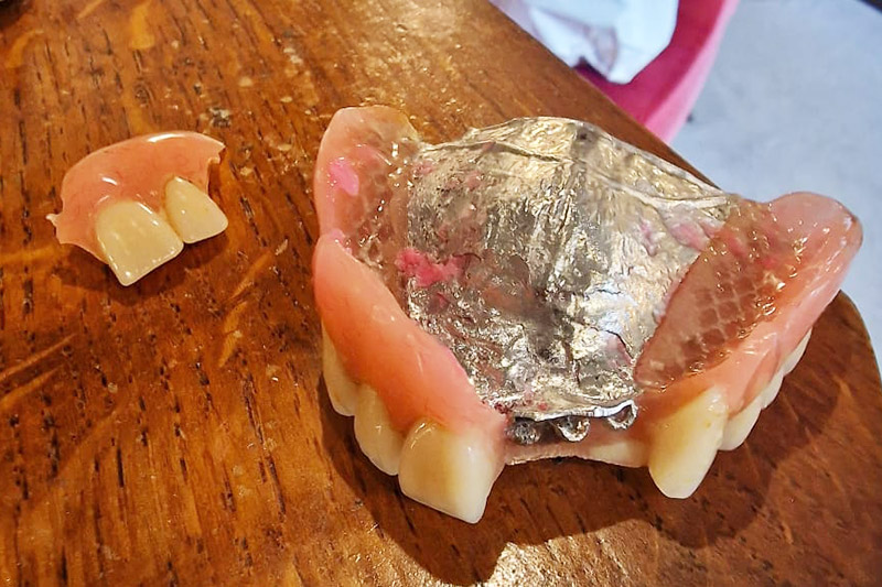 Broken Dentures - Repaired in Newbuy and Thatcham